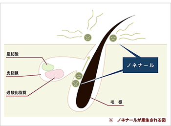 ノネナール