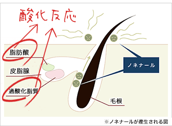 酸化反応